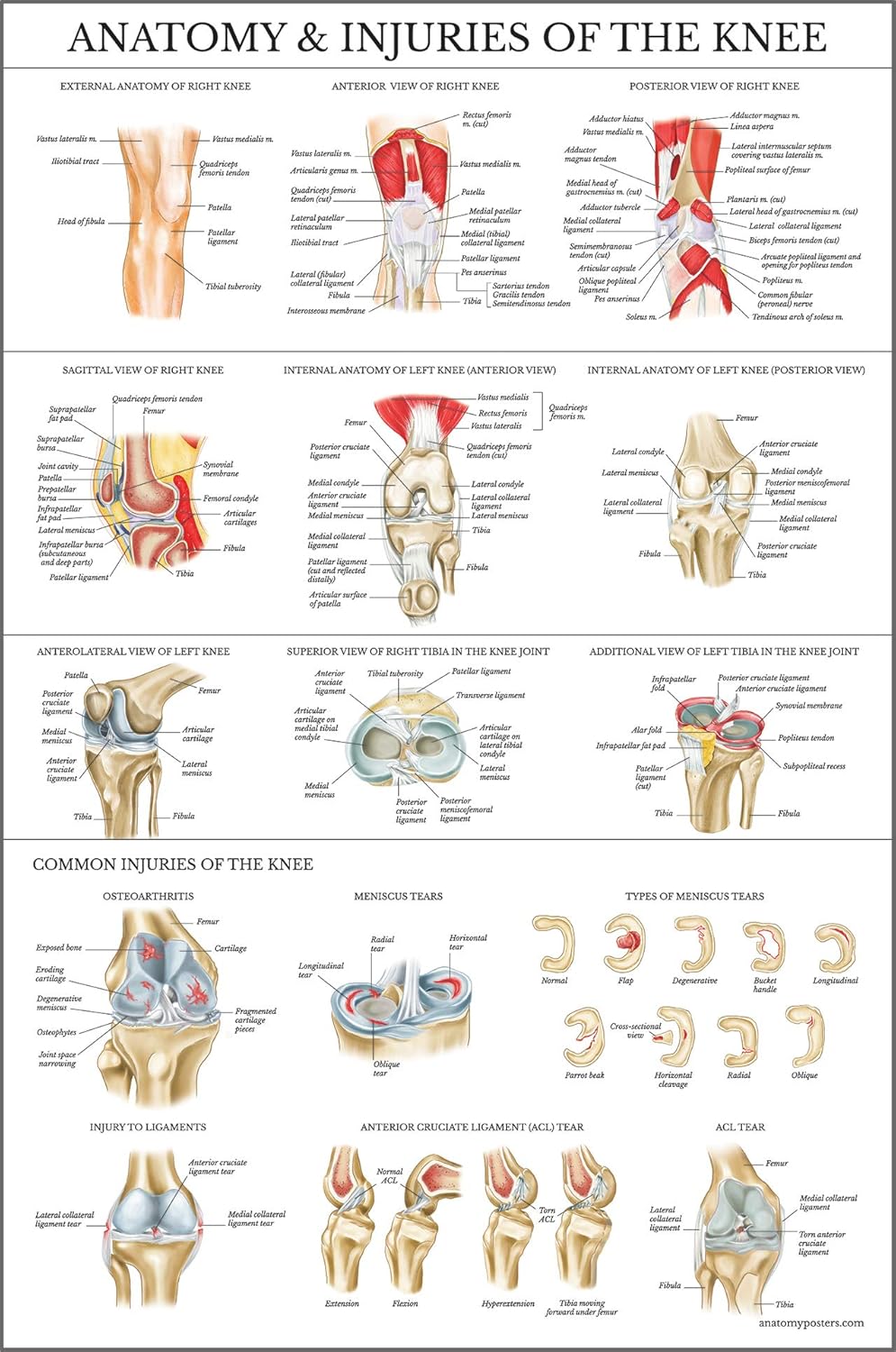 Laminated Anatomy and Injuries of the Knee Poster - Knee Joint Anatomical Chart - 18" x 24"