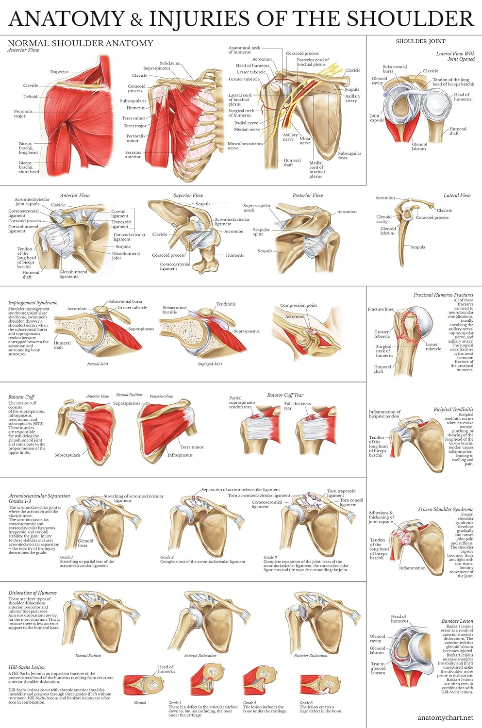 Laminated Anatomy and Injuries of The Shoulder Poster - Shoulder Joint Anatomical Chart
