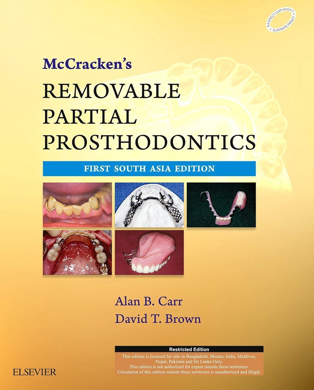 Mc Cracken'S Removable Partial Prosthodontics