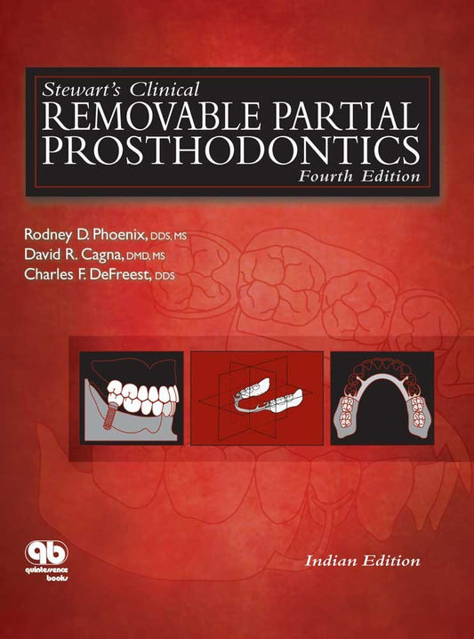 Stewart's Clinical Removable Partial Prosthodontics
