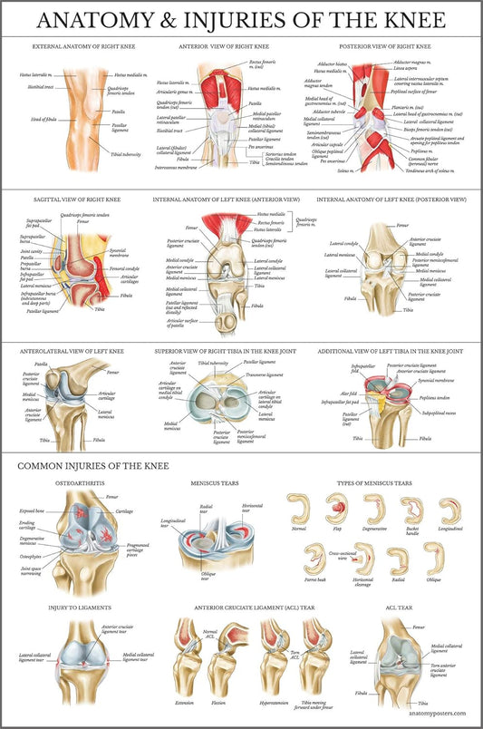 Laminated Anatomy and Injuries of the Knee Poster - Knee Joint Anatomical Chart - 18" x 24"