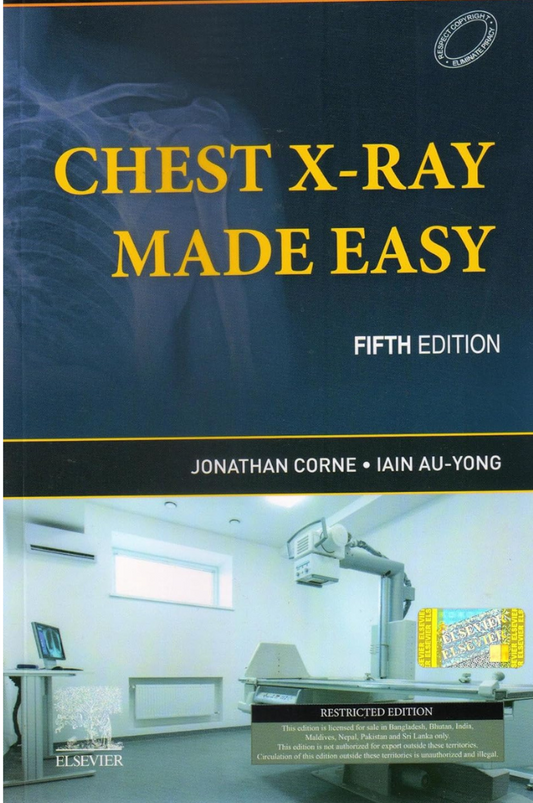 Chest X-Ray Made Easy